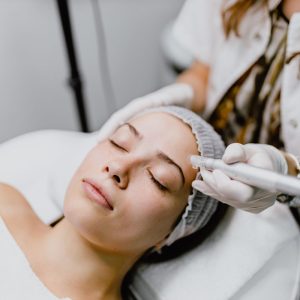 microneedling treatment